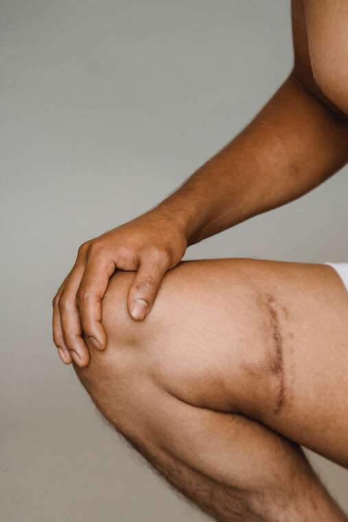 Rehabilitacja kolana – dlaczego jest tak ważna po poważnym wypadku?